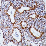 Immunohistochemistry - Anti-IDH3A Antibody (A89748) - Antibodies.com