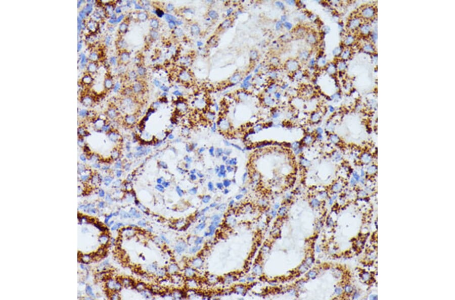 Immunohistochemistry - Anti-IDH3A Antibody (A89748) - Antibodies.com