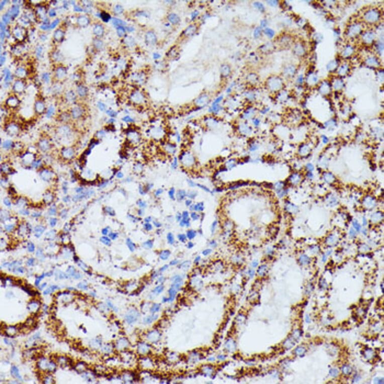 Immunohistochemistry - Anti-IDH3A Antibody (A89748) - Antibodies.com