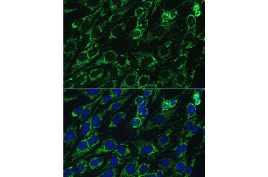 Immunofluorescence - Anti-IDH3A Antibody (A89748) - Antibodies.com