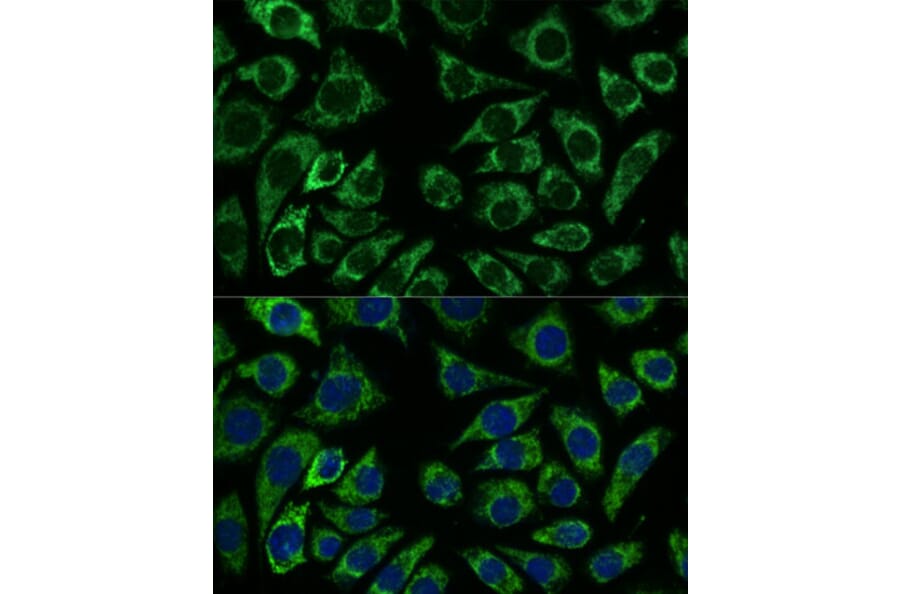 Immunofluorescence - Anti-IDH3A Antibody (A89748) - Antibodies.com