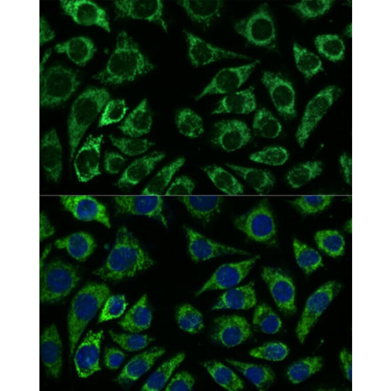 Immunofluorescence - Anti-IDH3A Antibody (A89748) - Antibodies.com