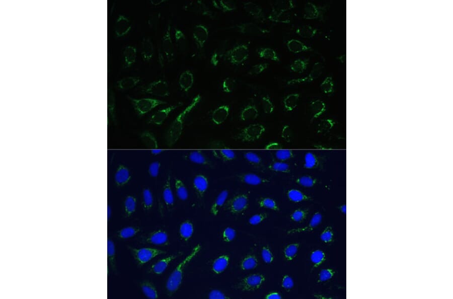 Immunofluorescence - Anti-IDH3A Antibody (A89748) - Antibodies.com