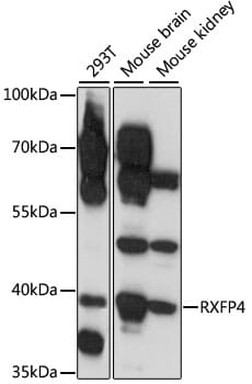 Western blot analysis of extracts of various cell lines, using Anti-RXFP4 Antibody (A15978) at 1:1,000 dilution.
Secondary antibody: Goat Anti-Rabbit IgG (H+L) (HRP) (AS014) at 1:10,000 dilution.
Lysates / proteins: 25µg per lane.
Blocking buffer: 3% non-fat dry milk in TBST.
Detection: ECL Enhanced Kit (RM00021).
Exposure time: 1s.