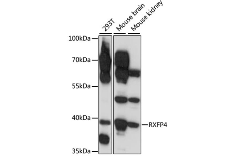 Western Blot - Anti-RXFP4 Antibody (A89749) - Antibodies.com