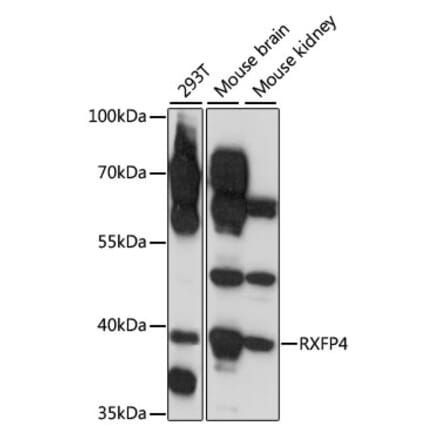 Western Blot - Anti-RXFP4 Antibody (A89749) - Antibodies.com