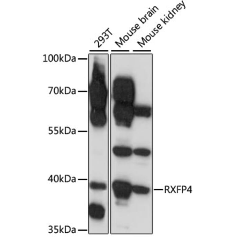 Western Blot - Anti-RXFP4 Antibody (A89749) - Antibodies.com
