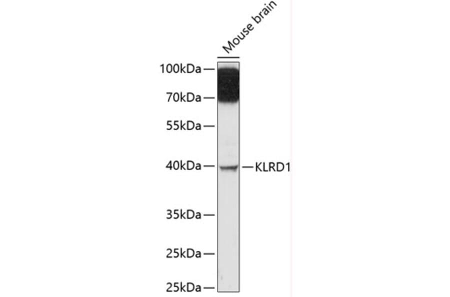 Western Blot - Anti-CD94 Antibody (A89750) - Antibodies.com
