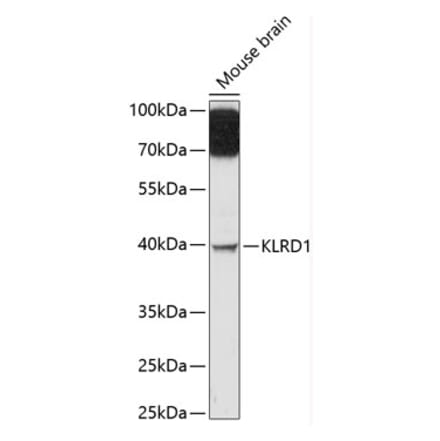 Western Blot - Anti-CD94 Antibody (A89750) - Antibodies.com
