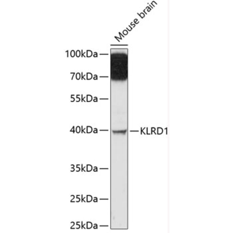 Western Blot - Anti-CD94 Antibody (A89750) - Antibodies.com