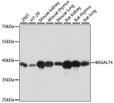 Western blot analysis of extracts of various cell lines, using Anti-B4GALT4 Antibody (A14693) at 1:1,000 dilution.
Secondary antibody: Goat Anti-Rabbit IgG (H+L) (HRP) (AS014) at 1:10,000 dilution.
Lysates / proteins: 25µg per lane.
Blocking buffer: 3% non-fat dry milk in TBST.
Detection: ECL Basic Kit (RM00020).
Exposure time: 1s.
