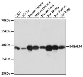 Western Blot - Anti-B4GALT4 Antibody (A89751) - Antibodies.com