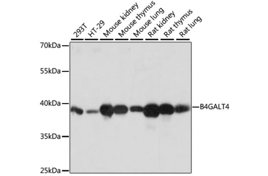 Western Blot - Anti-B4GALT4 Antibody (A89751) - Antibodies.com