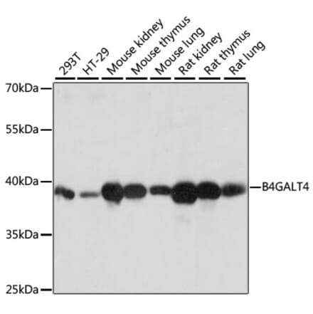 Western Blot - Anti-B4GALT4 Antibody (A89751) - Antibodies.com