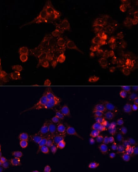 Immunofluorescence analysis of HeLa cells using Anti-B4GALT4 Antibody (A14693) at dilution of 1:100. Blue: DAPI for nuclear staining.