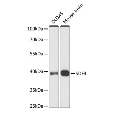 Western Blot - Anti-SDF4 Antibody (A89752) - Antibodies.com