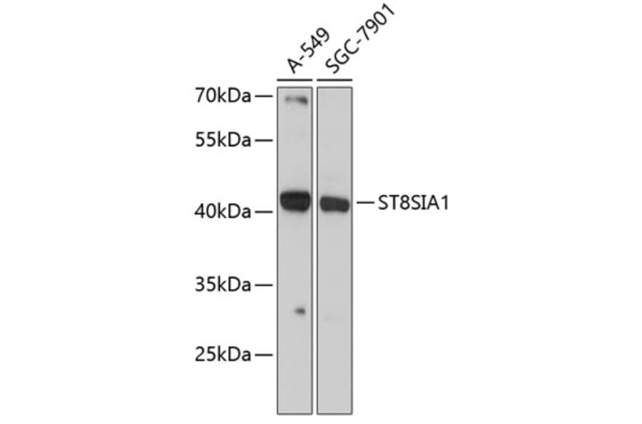 Western Blot - Anti-ST8SIA1 Antibody (A89753) - Antibodies.com