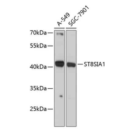 Western Blot - Anti-ST8SIA1 Antibody (A89753) - Antibodies.com