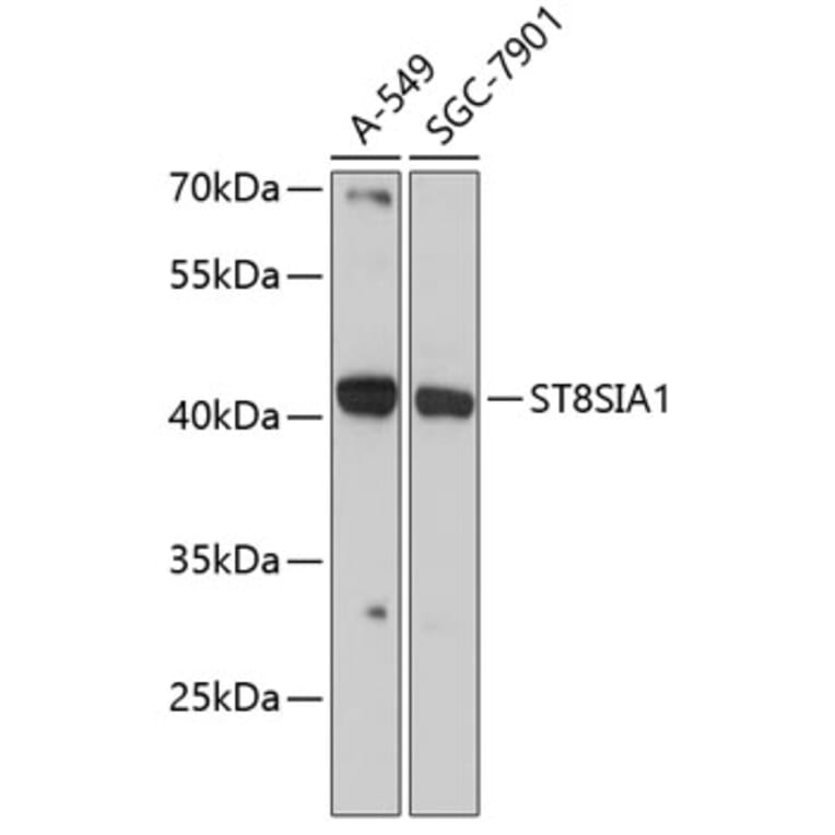 Western Blot - Anti-ST8SIA1 Antibody (A89753) - Antibodies.com