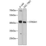 Western Blot - Anti-ST8SIA1 Antibody (A89753) - Antibodies.com