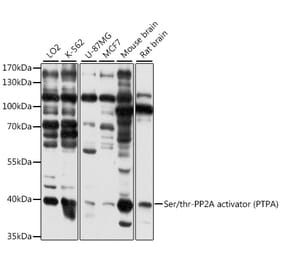 Western Blot - Anti-PPP2R4 Antibody (A89754) - Antibodies.com