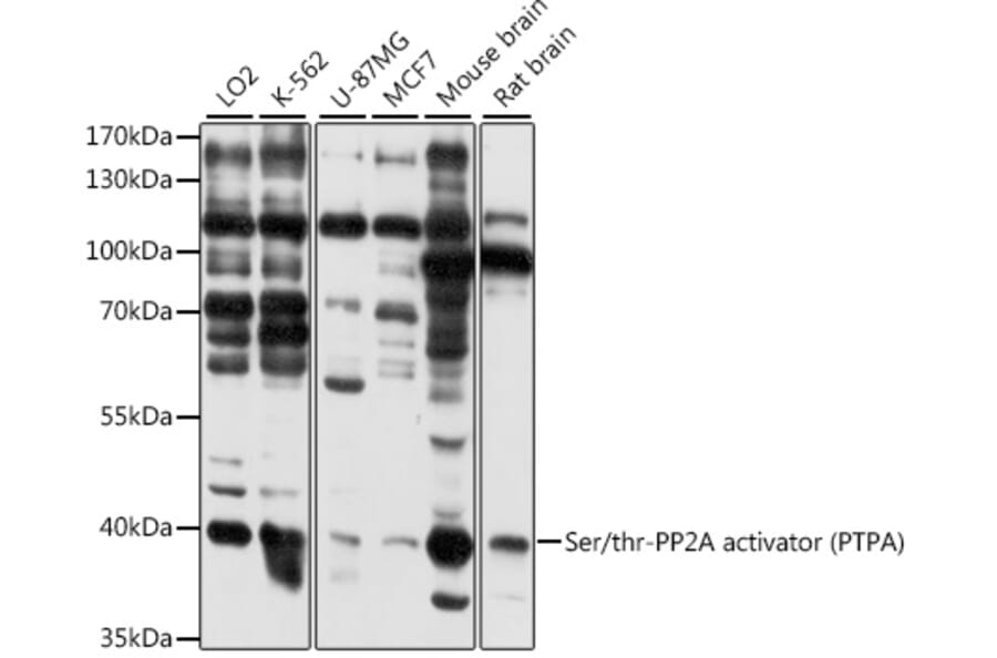 Western Blot - Anti-PPP2R4 Antibody (A89754) - Antibodies.com