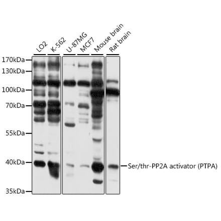 Western Blot - Anti-PPP2R4 Antibody (A89754) - Antibodies.com