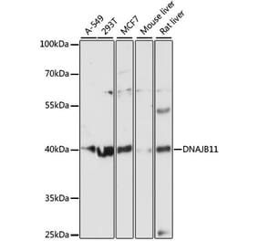 Western Blot - Anti-EDJ Antibody (A89756) - Antibodies.com