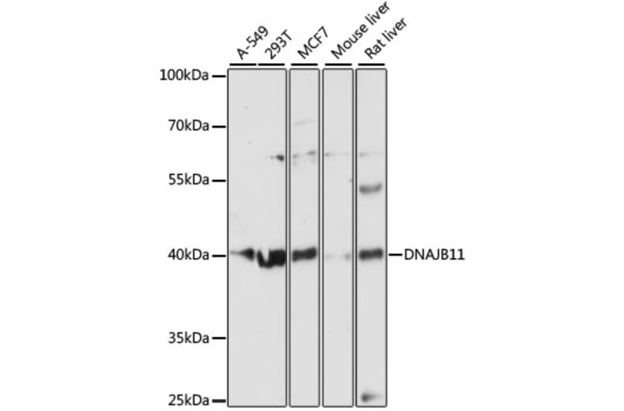 Western Blot - Anti-EDJ Antibody (A89756) - Antibodies.com