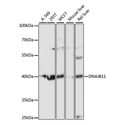Western Blot - Anti-EDJ Antibody (A89756) - Antibodies.com
