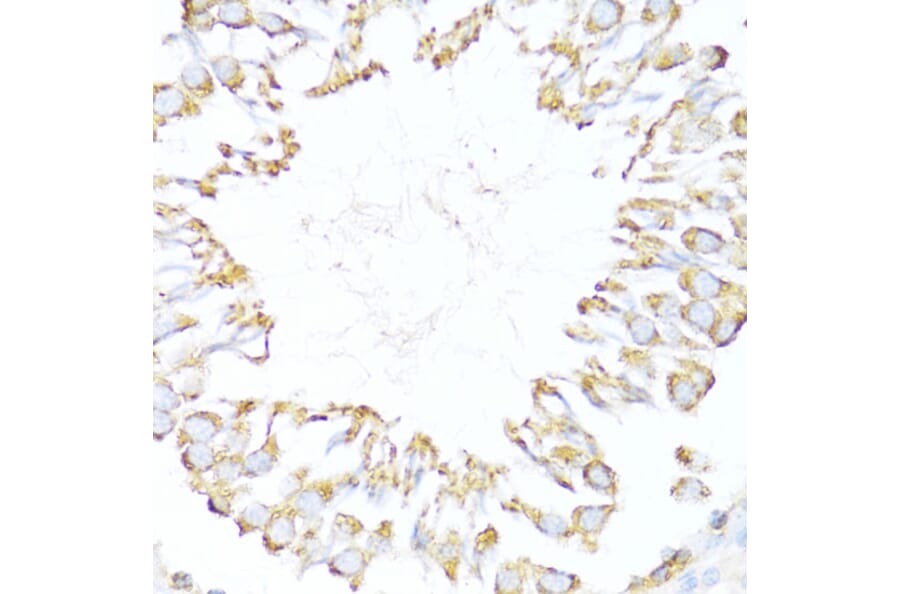 Immunohistochemistry - Anti-EDJ Antibody (A89756) - Antibodies.com