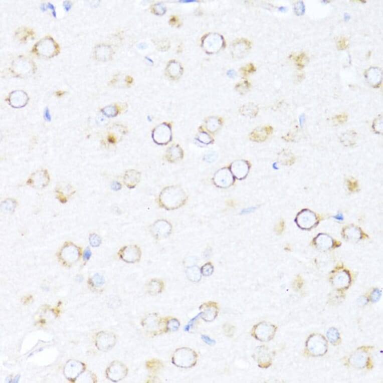 Immunohistochemistry - Anti-EDJ Antibody (A89756) - Antibodies.com