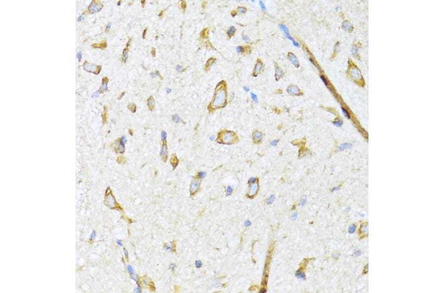 Immunohistochemistry - Anti-EDJ Antibody (A89756) - Antibodies.com