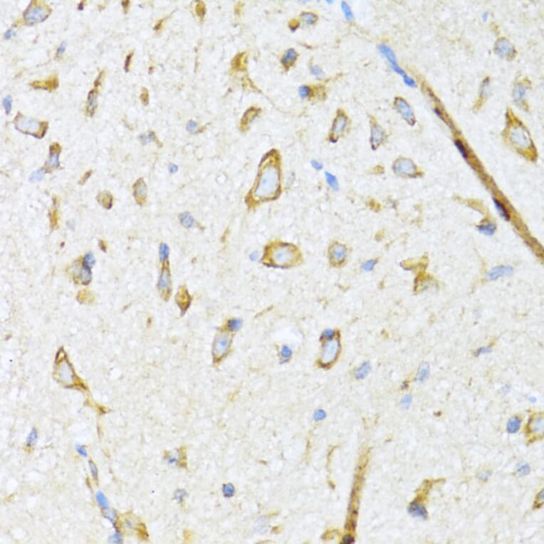 Immunohistochemistry - Anti-EDJ Antibody (A89756) - Antibodies.com
