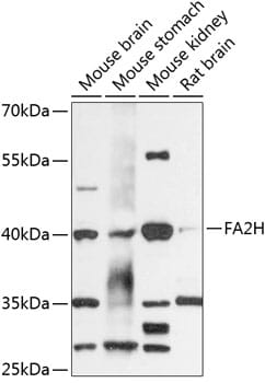 Western blot analysis of extracts of various cell lines, using Anti-FA2H Antibody (A13874) at 1:3000 dilution.
Secondary antibody: Goat Anti-Rabbit IgG (H+L) (HRP) (AS014) at 1:10,000 dilution.
Lysates / proteins: 25µg per lane.
Blocking buffer: 3% non-fat dry milk in TBST.
Detection: ECL Basic Kit (RM00020).
Exposure time: 30s.