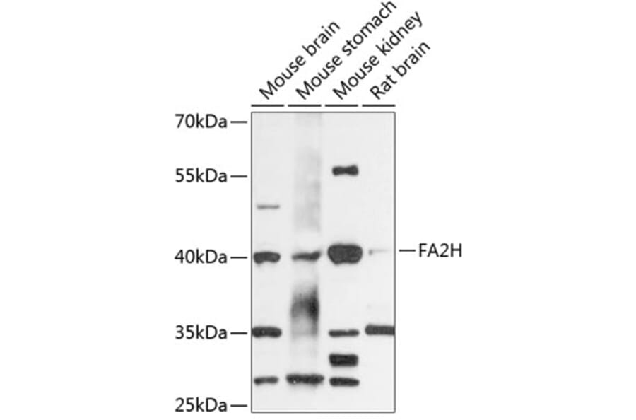 Western Blot - Anti-FA2H Antibody (A89757) - Antibodies.com