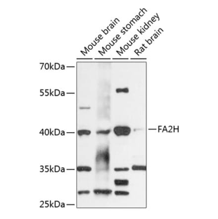 Western Blot - Anti-FA2H Antibody (A89757) - Antibodies.com