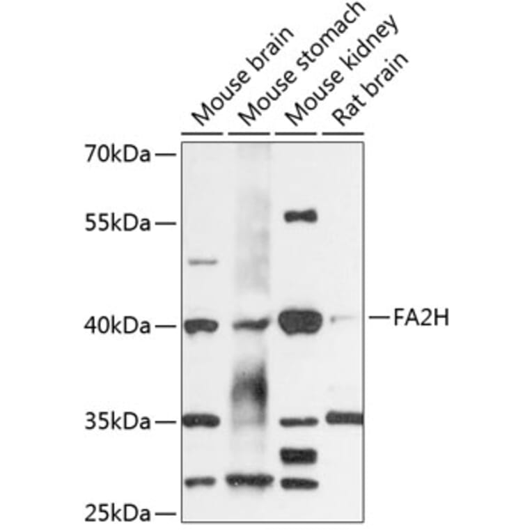 Western Blot - Anti-FA2H Antibody (A89757) - Antibodies.com