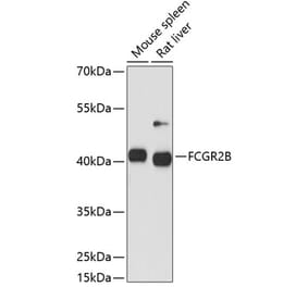 Western Blot - Anti-CD32 Antibody (A89758) - Antibodies.com