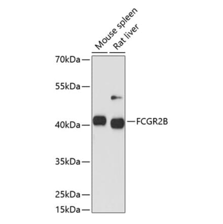 Western Blot - Anti-CD32 Antibody (A89758) - Antibodies.com