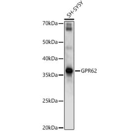 Western Blot - Anti-GPR62 Antibody (A89759) - Antibodies.com