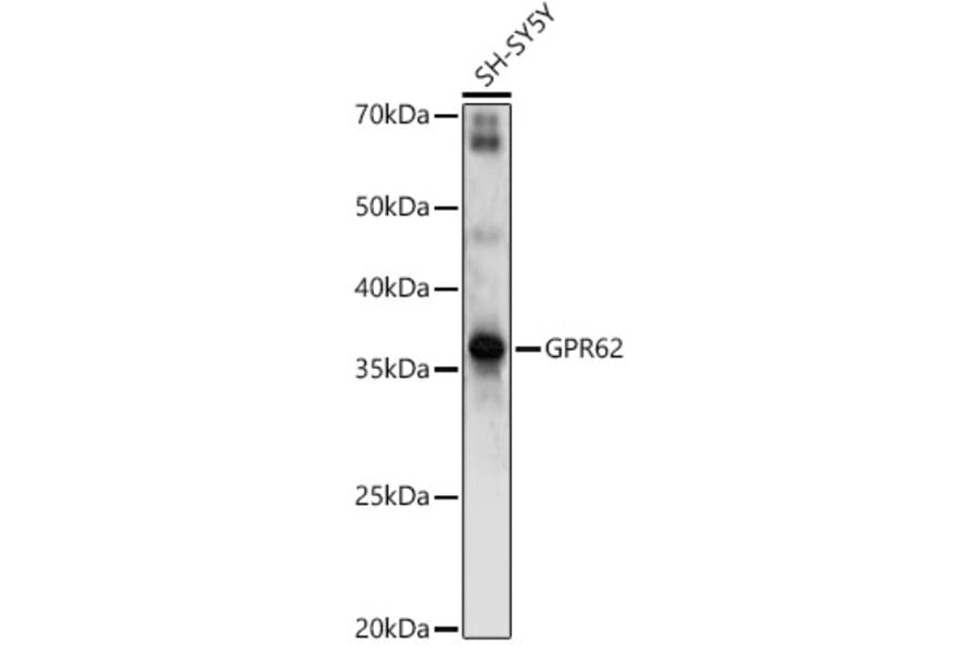 Western Blot - Anti-GPR62 Antibody (A89759) - Antibodies.com