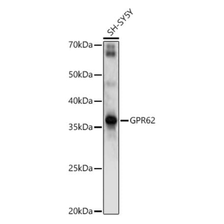 Western Blot - Anti-GPR62 Antibody (A89759) - Antibodies.com