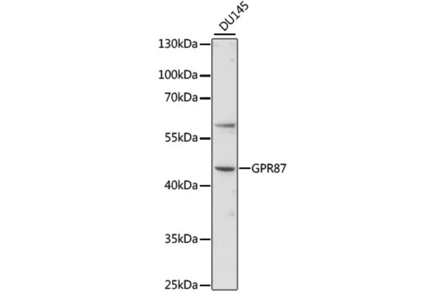 Western Blot - Anti-GPCR GPR87 Antibody (A89760) - Antibodies.com