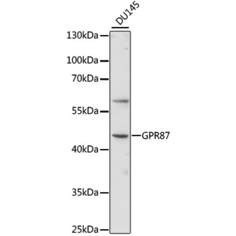 Western Blot - Anti-GPCR GPR87 Antibody (A89760) - Antibodies.com