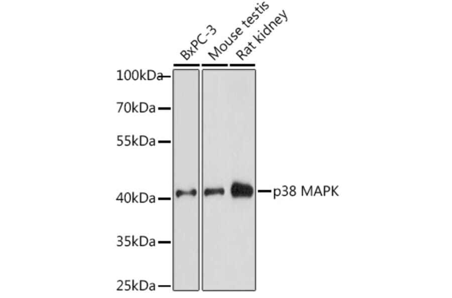 Western Blot - Anti-p38 alpha/MAPK14 Antibody (A89761) - Antibodies.com