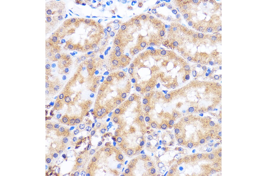 Immunohistochemistry - Anti-p38 alpha/MAPK14 Antibody (A89761) - Antibodies.com