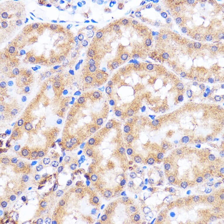 Immunohistochemistry - Anti-p38 alpha/MAPK14 Antibody (A89761) - Antibodies.com