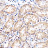 Immunohistochemistry - Anti-p38 alpha/MAPK14 Antibody (A89761) - Antibodies.com