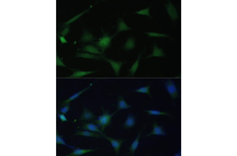 Immunofluorescence - Anti-p38 alpha/MAPK14 Antibody (A89761) - Antibodies.com